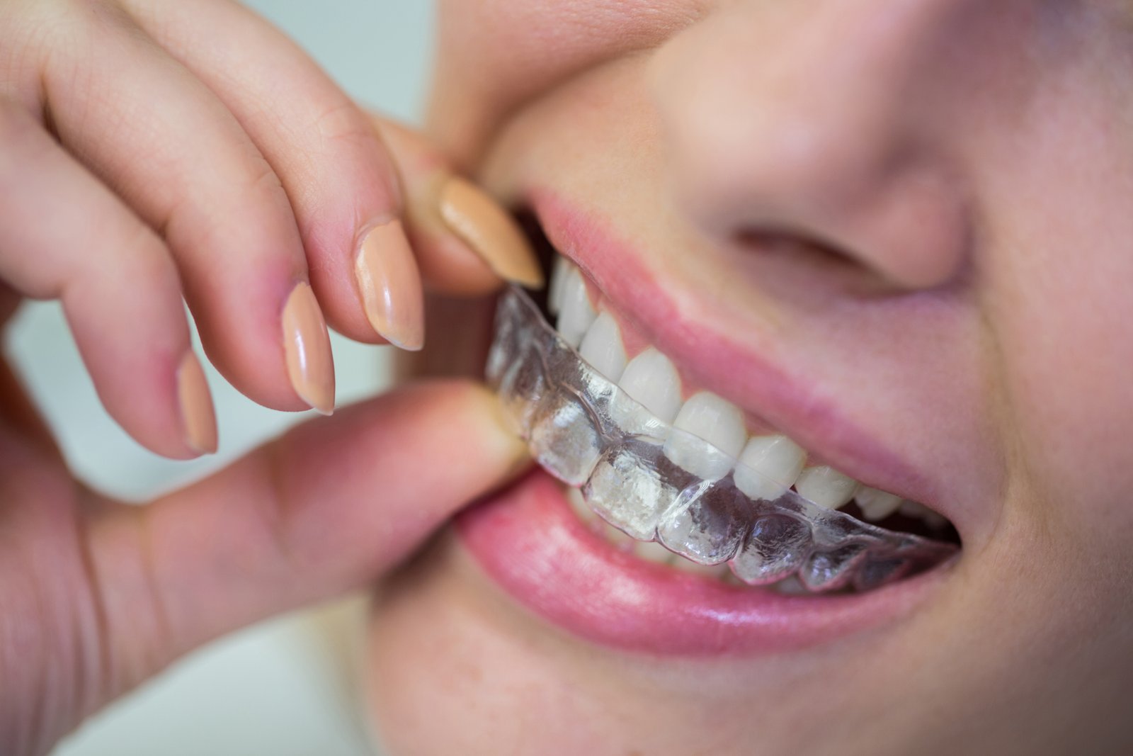 Technologies utilisées pour les soins dentaires chez Ayodent